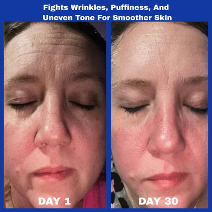 CellPlump™ Anti-Wrinkle Cream